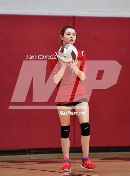 Thumbnail 3 in Bergman vs Harmony Grove photogallery.