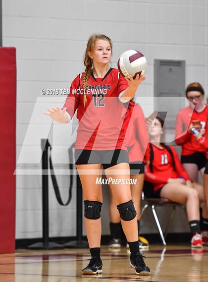 Thumbnail 1 in Bergman vs Harmony Grove photogallery.