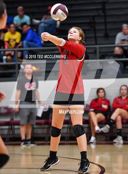 Thumbnail 2 in Bergman vs Harmony Grove photogallery.