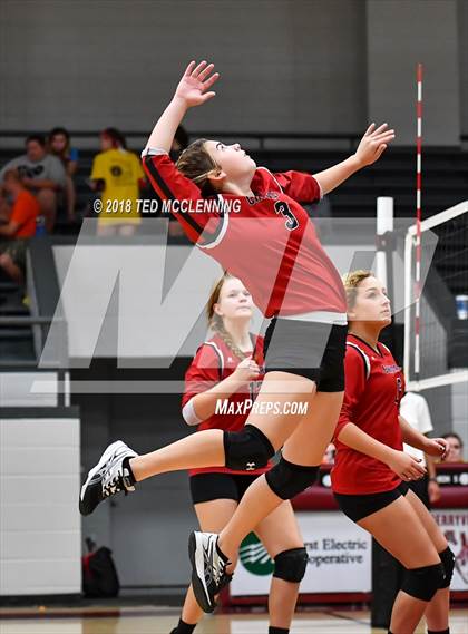Thumbnail 3 in Bergman vs Harmony Grove photogallery.