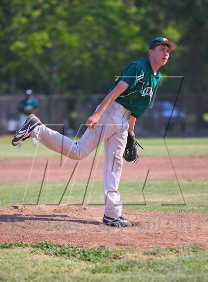 Thumbnail 2 in Kennedy vs. Sacramento photogallery.