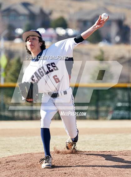 Thumbnail 2 in Highlands Ranch @ Dakota Ridge photogallery.