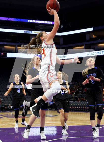 Thumbnail 3 in St. Francis vs. Davis photogallery.