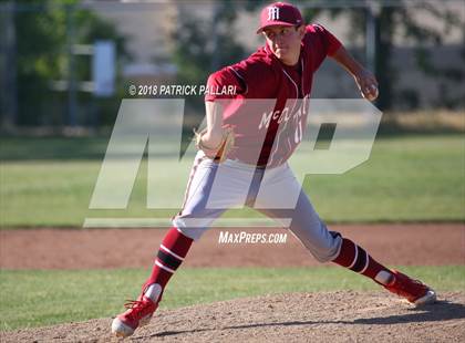 Thumbnail 2 in McClatchy @ Oak Ridge (CIF SJS D1 Playoffs) photogallery.