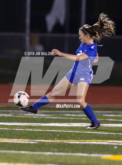 Thumbnail 1 in Foothill @ Granada photogallery.
