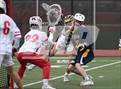 Photo from the gallery "Bellevue @ Mater Dei"