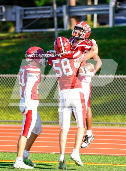 Thumbnail 3 in Hackley @ Morristown-Beard photogallery.
