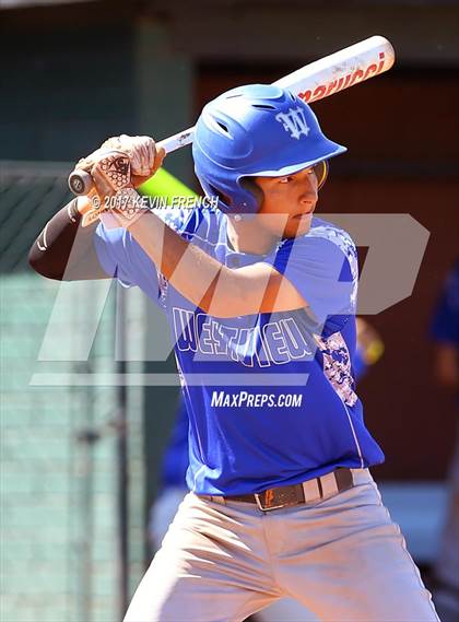 Thumbnail 1 in Shadow Mountain vs. Westview photogallery.