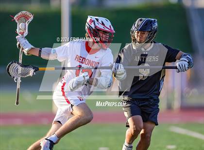 Thumbnail 1 in Peninsula @ Redondo Union photogallery.