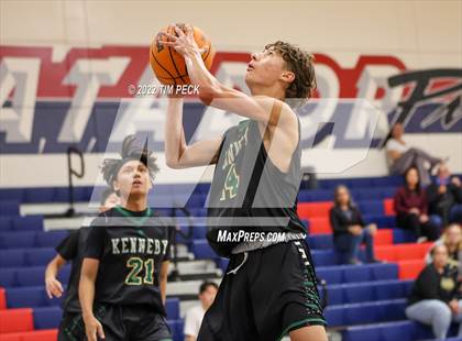 Thumbnail 2 in Kennedy @ Bolsa Grande photogallery.