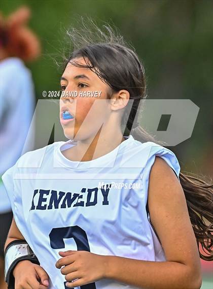 Thumbnail 1 in Kennedy vs Littleton photogallery.
