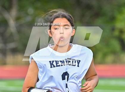 Thumbnail 1 in Kennedy vs Littleton photogallery.