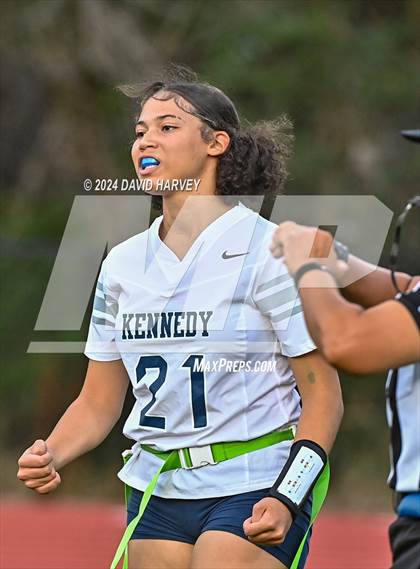 Thumbnail 1 in Kennedy vs Littleton photogallery.