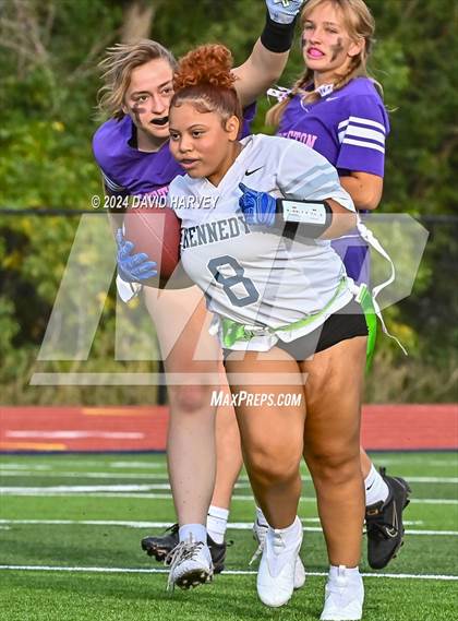 Thumbnail 1 in Kennedy vs Littleton photogallery.