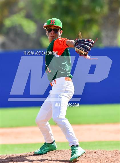 Thumbnail 3 in Burbank vs Houston [Sam] photogallery.