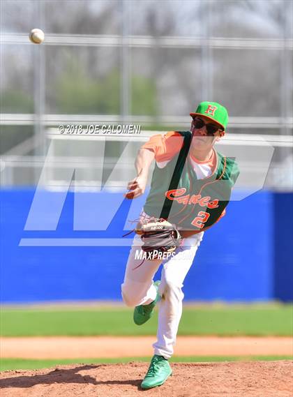 Thumbnail 3 in Burbank vs Houston [Sam] photogallery.