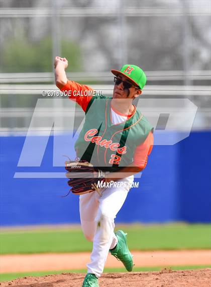 Thumbnail 2 in Burbank vs Houston [Sam] photogallery.