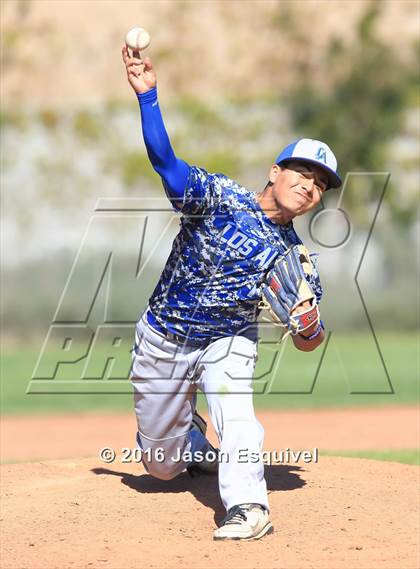 Thumbnail 2 in California vs. Los Altos photogallery.