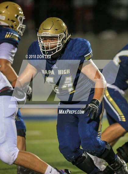 Thumbnail 3 in East Union vs. Napa photogallery.