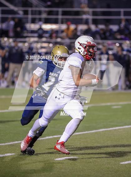 Thumbnail 1 in East Union vs. Napa photogallery.