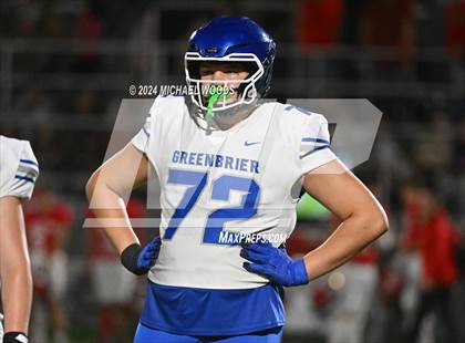 Thumbnail 2 in Greenbrier @ Farmington photogallery.
