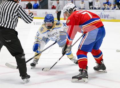 Thumbnail 3 in Santa Margarita @ Los Alamitos photogallery.