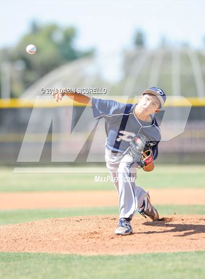 Thumbnail 3 in Pacifica @ Tustin <HOLD - past 30 day policy</b> photogallery.