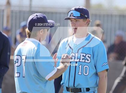 Thumbnail 1 in Grossmont @ Granite Hills photogallery.