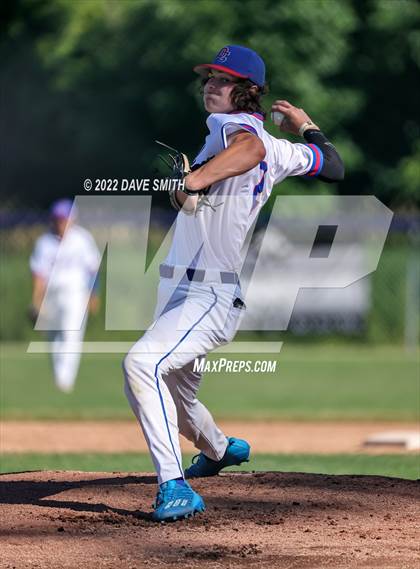 Thumbnail 3 in Pleasant Valley @ Davenport Central photogallery.