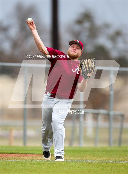 Thumbnail 2 in Ardmore @ Whitesboro photogallery.
