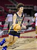 Photo from the gallery "Clovis vs. Sanger"