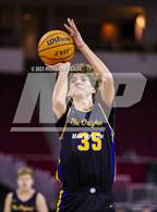 Photo from the gallery "Clovis vs. Sanger"