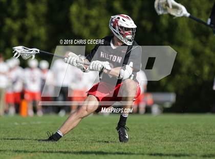 Thumbnail 1 in Hilton @ Churchville-Chili photogallery.