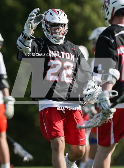 Thumbnail 1 in Hilton @ Churchville-Chili photogallery.