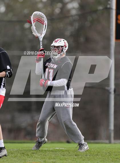 Thumbnail 3 in Hilton @ Churchville-Chili photogallery.