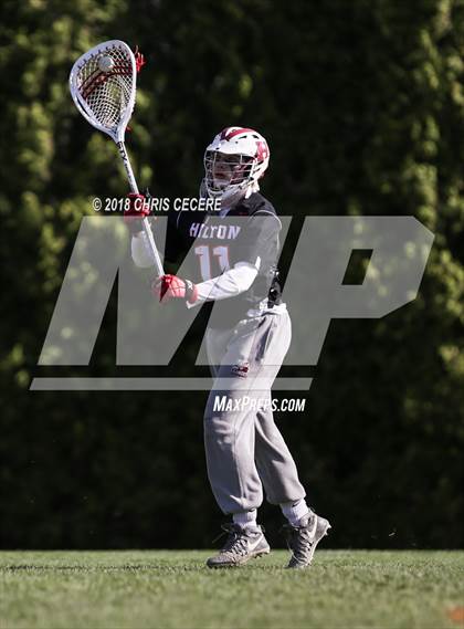 Thumbnail 1 in Hilton @ Churchville-Chili photogallery.