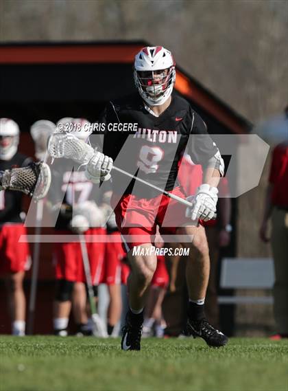 Thumbnail 3 in Hilton @ Churchville-Chili photogallery.