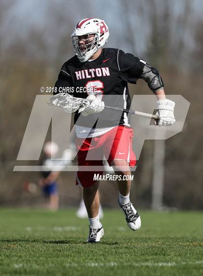 Thumbnail 3 in Hilton @ Churchville-Chili photogallery.