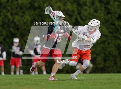 Thumbnail 1 in Hilton @ Churchville-Chili photogallery.