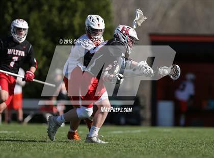 Thumbnail 2 in Hilton @ Churchville-Chili photogallery.