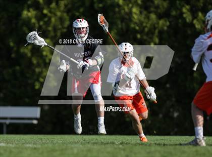 Thumbnail 2 in Hilton @ Churchville-Chili photogallery.