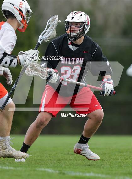 Thumbnail 3 in Hilton @ Churchville-Chili photogallery.