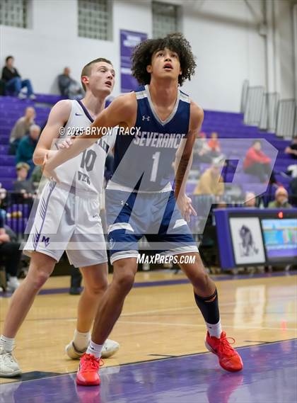 Thumbnail 1 in Severance @ Mountain View photogallery.