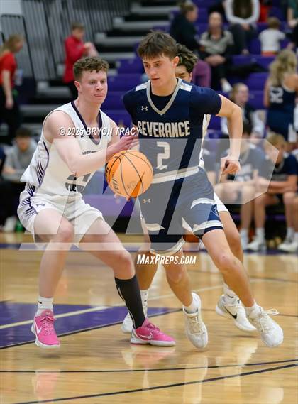 Thumbnail 1 in Severance @ Mountain View photogallery.