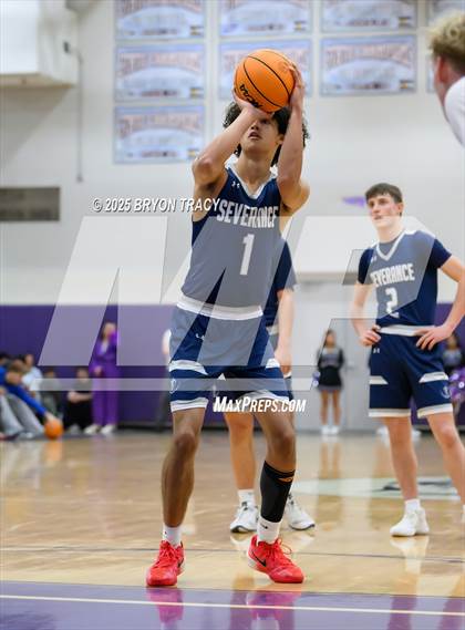 Thumbnail 2 in Severance @ Mountain View photogallery.