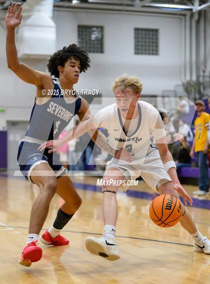 Thumbnail 3 in Severance @ Mountain View photogallery.