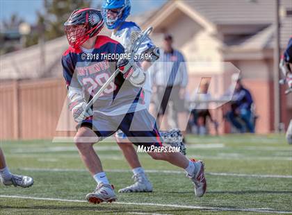 Thumbnail 1 in Kent Denver @ Highlands Ranch photogallery.
