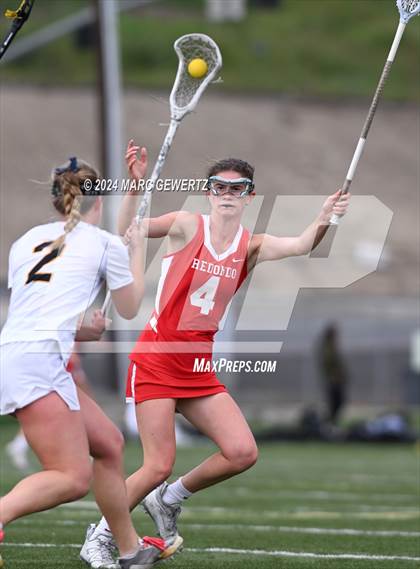 Thumbnail 1 in Redondo Union @ Foothill photogallery.
