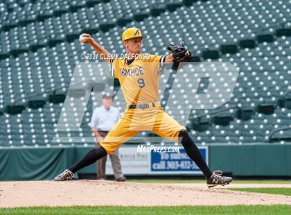 Thumbnail 2 in Arapahoe vs Dakota Ridge (Coors Field) photogallery.