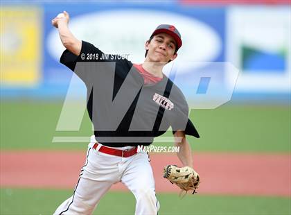 Thumbnail 2 in HVMSBL High School Futures (Team Black vs Team Blue) photogallery.